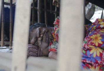 Ұсқынсыз бойжеткенге дәрігерлер көмектесе алмайтынын мәлімдеді (ФОТО)