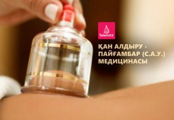 Қан алдыру - Пайғамбар (с.а.у.) медицинасы
