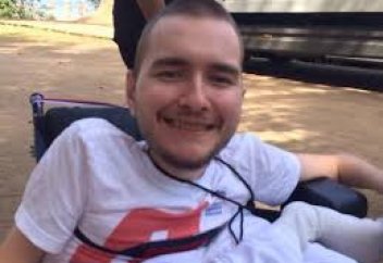 Адамның басын алмастыру операциясының қашан жасалатыны белгілі болды