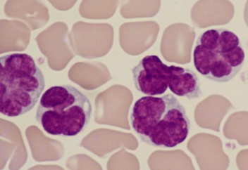 Қауіпті вирус сирек кездесетін қатерлі ісіктің түрін тудырады