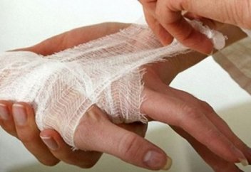 Күйік жарақаты кезінде көрсетілетін алғашқы медициналық көмек