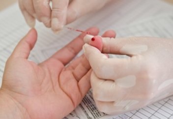 Не себепті қанды атауы жоқ саусақтан алады?