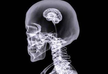 Кому нельзя делать рентген