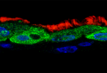 Вирустың иммунитетті қалай манипуляциялайтыны белгілі болды