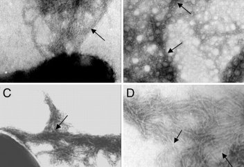 Легочный монстр. Найдан самый смертоносный штамм туберкулеза.  Найдены причины высокой устойчивости туберкулезной палочки к лекарствам и иммунному ответу человека