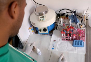 Найден способ остановить распространение ВИЧ