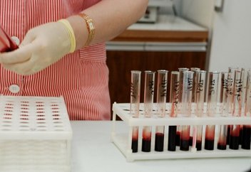 Ғалымдар ВИЧ-тің пайда болған жері мен уақытын анықтады