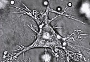 Иммундық миелоидтік жасуша жас ұлғайған сайын организмге тек зиянын тигізетін болып шықты