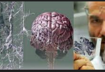 Аса қауіпті дертті көз торынан анықтау жолы табылды