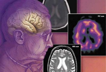 Алжуды анықтайтын технологияны жасауға 172 млн доллар бөлінеді