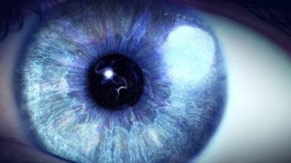 Глаза могут рассказать очень много о вашем здоровье (видео)