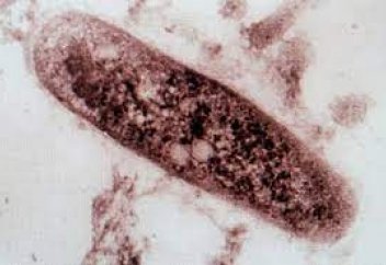 Кох таяқшасының ем-домға бой бермеуінің әрі дәріге төзімділігінің құпиясы ашылды