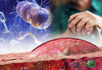 Вирустық инфекция организмге кәрілік секілді әсер етеді