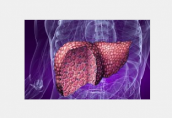 Ожирение печени: симптомы, лечение и профилактика