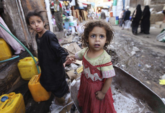 6 жылда Йеменде 10 мыңнан аса бала көктей солған