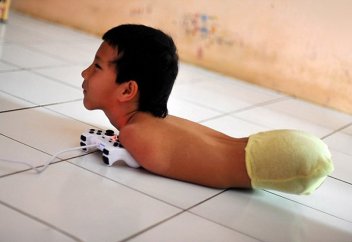 Аяғы жоқ, қолы жоқ бала қайтіп күн көрер? - ВИДЕО/ФОТО