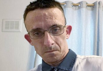 Мужчина перенес операцию на мозге и вырос на 45 сантиметров