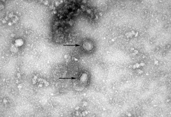 Китай опубликовал снимок нового коронавируса