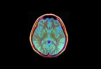 «Ақыл-ойды оқитын дулыға» адам анайы контентті көргенде дабыл қағады