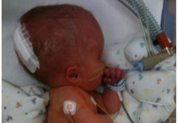 Мисыз туылған баланың өмірінде ғажайып оқиға орын алды (ФОТО)