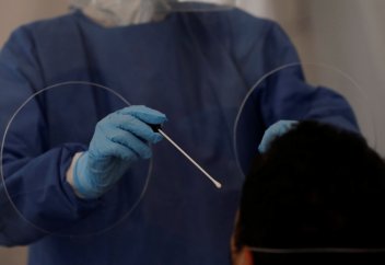 Зафиксирован необычный случай передачи COVID-19 человеку