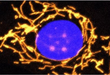 Гендік терапия соқырлыққа бастайтын, емі жоқ көз ауруынан айықтырады