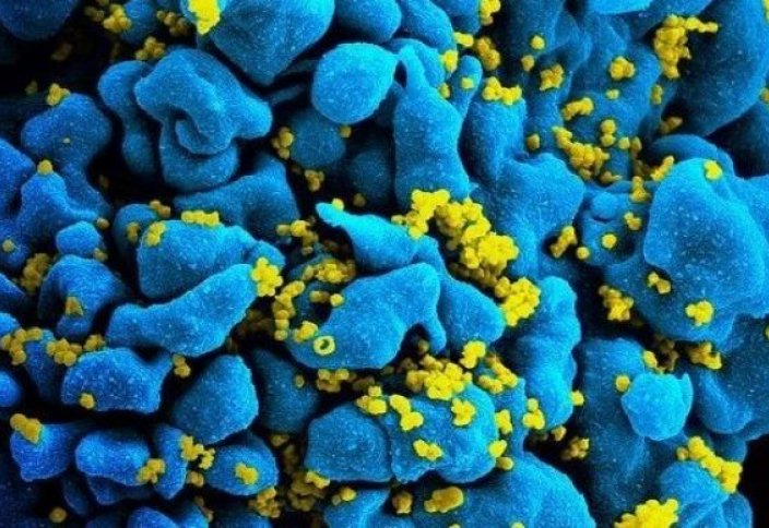 Ученые создали иммунные клетки, способные бороться с ВИЧ