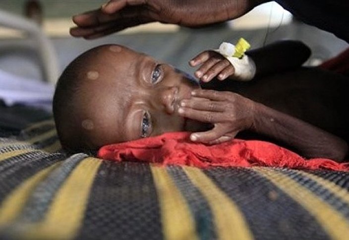 Количество голодающих йеменских детей возрастает