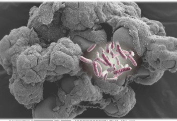 Бактерияның антибиотикке төзімділігінің тағы бір құпиясы ашылды