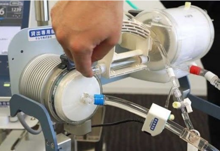 [Видео] Как выглядит аппарат экстракорпоральной мембранной оксигенации (ЭКМО), использующийся при лечении коронавирусного заболевания?