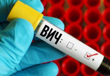 АИТВ-дан қорғану тәсілі табылды