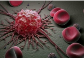 Канадалық дәрігерлер диабет дәрісінің қатерлі ісікті емдеуге тиімді екенін анықтады