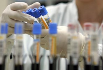 За 19 лет в Казахстане зарегистрировано 24,5 тыс. случаев заражения ВИЧ-инфекцией