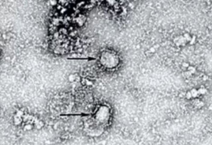 Уже не умеренный. ВОЗ повысила уровень угрозы коронавируса. В Китае назвали срок лечения пневмонии нового типа. Китайские ученые начали разрабатывать мРНК-вакцину от коронавируса