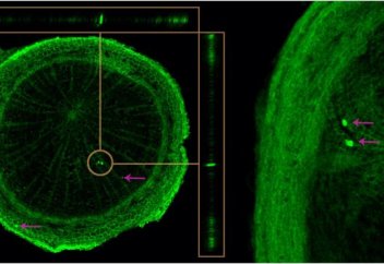 Әлемді микропластиктен ағаштың бір түрімен тазартуға болады