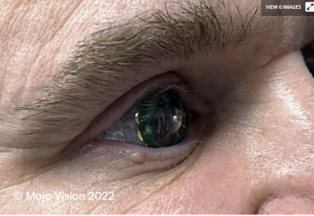 Толықтырылған «шындыққа» ие контактілі линзалар пайда болды: прототип сынақтан сәтті өтті