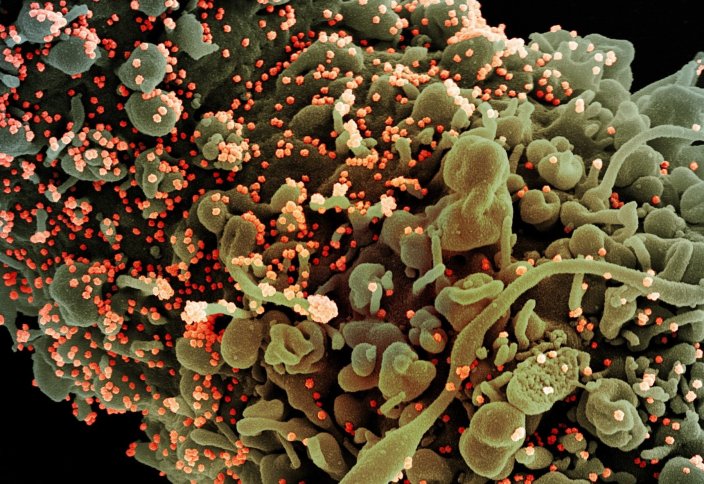 Фото: как выглядит зараженная коронавирусом клетка