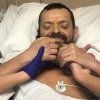 Тарихта тұңғыш рет адамға қол жалғанды