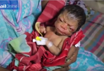 БАНГЛАДЕШТЕ СЕКСЕНДЕГІ ҚАРИЯҒА ҰҚСАЙТЫН СӘБИ ДҮНИЕГЕ КЕЛДІ (ВИДЕО)