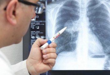 Дәрігер пневмония кезінде не істеуге болмайтынын айтты