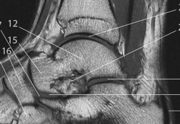 Разные: Ученые впервые сумели исследовать «рулевое колесо» нашего тела под нагрузкой