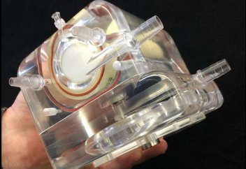 Новые искусственные лёгкие обещают уместить в рюкзак