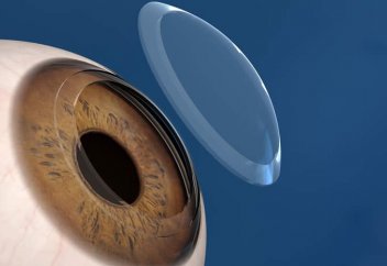 Адамзаттың 97%-ы шалдыққан көз ауруының емі табылды