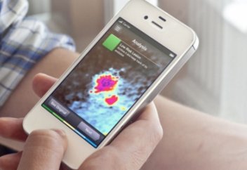 Елімізде тері обырын анықтайтын мобильді қосымша іске қосылды (видео)