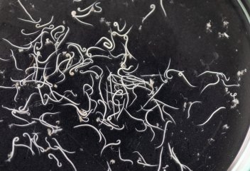 Токсоплазма паразиті туралы (видео)