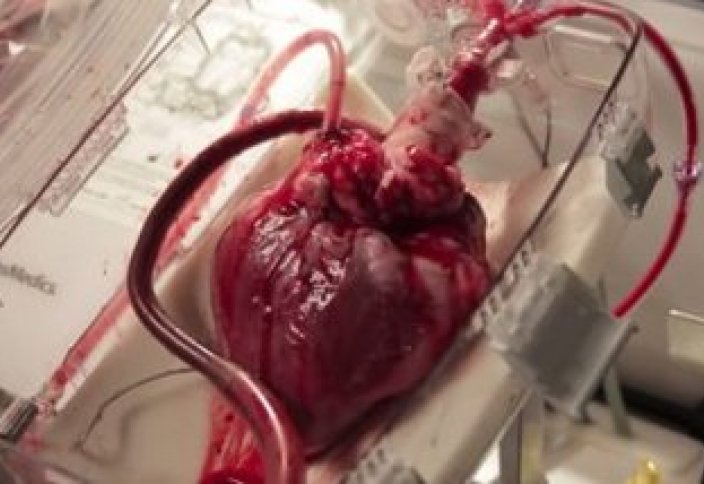 В ближайшем будущем человеку начнут пересаживать свиное сердце