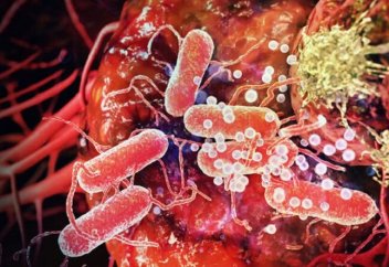 Қауіпті бактерия метастазды тоқтатты