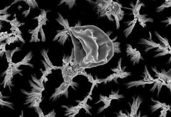 Бактерия төзімділігін қалыптастыра алмайтын, көптеген салада пайдаланылатын технология пайда болды