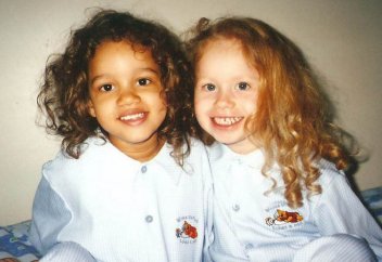 Бір-біріне мүлде ұқсамайтын егіз қыздар көпшілікті таң қалдырды