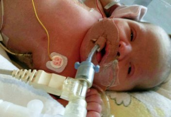 Денесі қанға емес, суға толған нәресте дүниеге келді